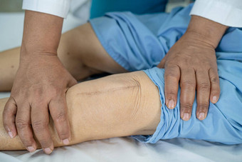 亚洲高级上了年纪的夫人女人病人显示伤疤外科手术总计膝盖联合更换缝合伤口手术关节成形术床上护理医院病房健康的强大的医疗概念