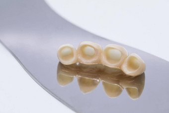 牙科陶瓷贴面板冠金属免费的陶瓷牙科冠