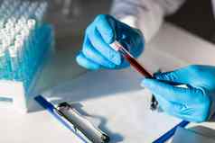 测试管血手研究员背景表格测试管剪贴板描述免疫研究