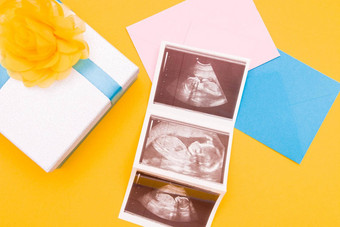 超声波图片银盒子蓝色的<strong>丝带黄</strong>色的花<strong>黄</strong>色的背景的地方复制前视图女人怀孕了男孩女孩惊喜照片礼物怀孕概念