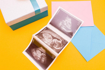 超声波图片银盒子蓝色的丝带黄色的花黄色的背景的地方复制前视图女人怀孕了男孩女孩惊喜照片礼物怀孕概念