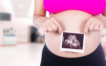 怀孕了女人手持有超声波照片医院背景