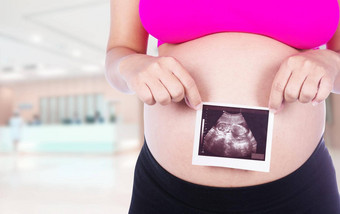 怀孕了女人手持有超声波照片医院背景