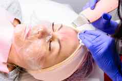 面部清洗超声波洗涤器清洗脸角质化上皮细胞多余的脂肪堵塞皮脂腺黑头粉刺