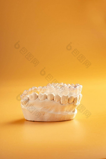 inivisalign牙套对准器美丽的微笑白色牙齿看<strong>不见</strong>的隐适美塑料牙科牙齿括号