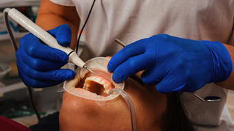 牙医删除凶悍的人超声波病人牙医牵开器隔离嘴唇牙龈