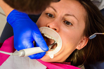 病人牙医检查治疗咀嚼的牙齿删除馅<strong>料</strong>牵开器