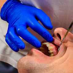 参观牙医牙医评估口服腔标识问题区域牙齿瘘口牙龈炎