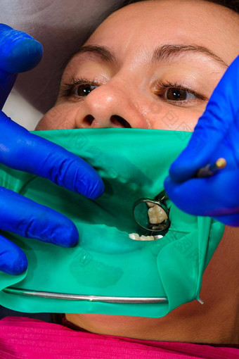 牙医对待病人的牙橡胶大坝钻镜子