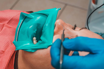 牙医对待牙现代方法橡胶大坝无菌牙治疗