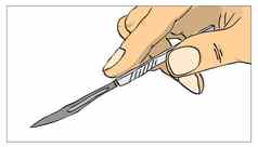 外科手术手术刀