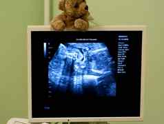 产科医生检查怀孕了肚子超声波扫描