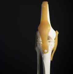 医疗膝盖联合弯月面塑料示范教学模型