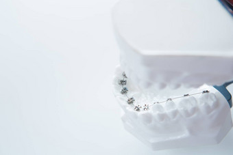 牙科较低的下巴支架牙套模型白色