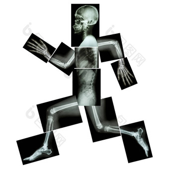 有氧锻炼人类骨运行身体x射线头脖子肩膀肩膀手臂肘前臂手手指联合胸腔腹部回来骨盆臀部大腿腿膝盖脚非常