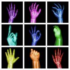 集合色彩斑斓的x射线手