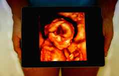 女人持有平板电脑概念超声波图像婴儿