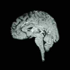磁共振成像核磁共振大脑医疗科学医疗保健概念