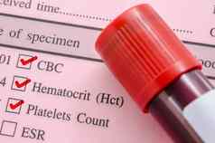 cbc血细胞比容血小板数请求筛选测试