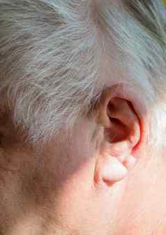 左耳朵头发花白的上了年纪的男人。听力损失听力问题概念康复充耳不闻人