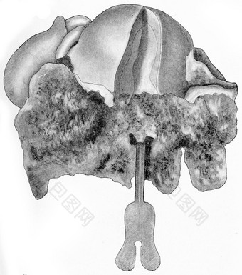 cylindric-cell上皮瘤子宫颈uteri古董无最大残留<strong>限量</strong>