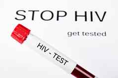 样本血艾滋病毒测试停止艾滋病毒测试