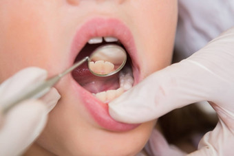 儿科牙医检查女孩牙齿牙医椅子