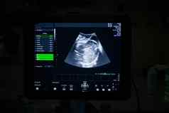 医疗超声波机图像劳动交付房间医院
