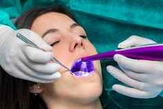 牙医防止牙衰变领导固化光女孩