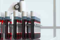 血测试管实验室呈现
