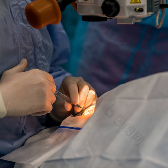 医疗外科手术眼睛手术