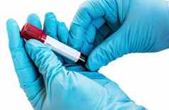 血样本测试管分析科维德测试实验室
