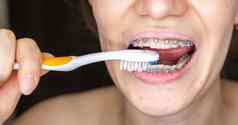 女孩牙套牙齿刷牙牙齿牙刷