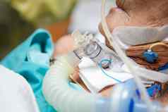 病人气管造口术呼吸机医院