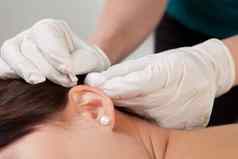 耳针灸治疗