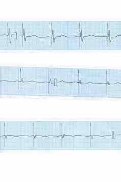 心蓝色的心电图