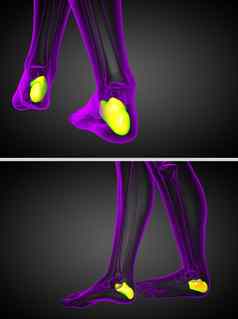 呈现医疗插图跟骨骨