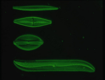 <strong>硅藻</strong>海显微镜