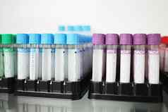 医疗测试管彩色的帽测试血液体
