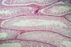 老鼠睾丸精子组织交叉部分