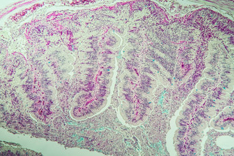慢蠕虫组织学肠横向