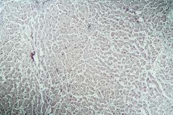 肝炎标记生病的组织显微镜
