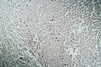 肝炎标记生病的组织显微镜