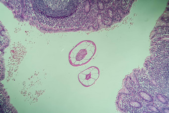 奥乌里斯蛲虫肠显微镜
