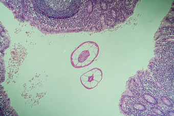 奥乌里斯<strong>蛲虫</strong>肠显微镜