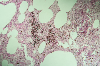 肺组织灰尘肺显微镜