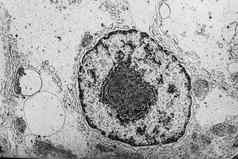 细胞核细胞器电子显微镜
