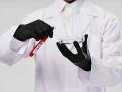 血测试黑色的手套分析实验室治疗