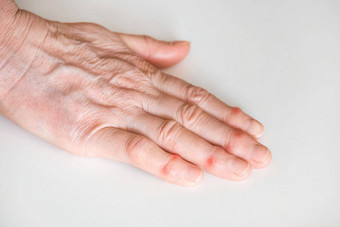生病的女手指上了年纪的男人的手白色背景