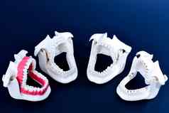 牙医矫正牙齿模型
